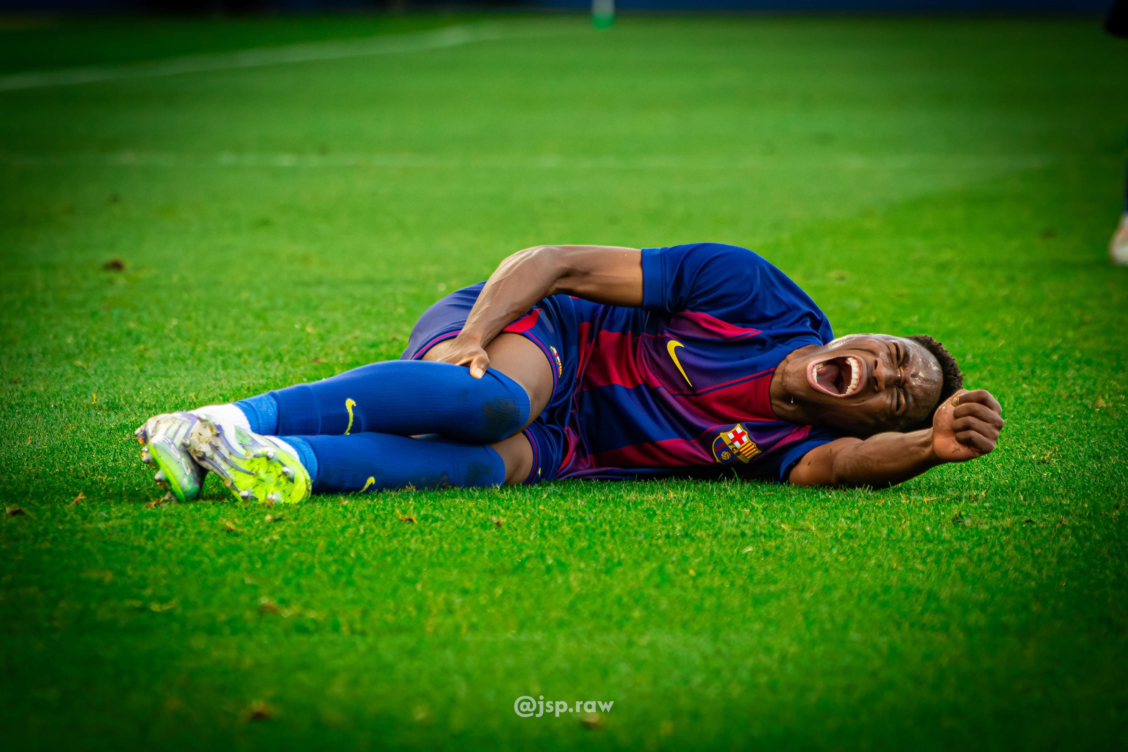 Sama Nomoko en el momento de la lesión de ligamento en el Barça sub19-Eintracht Frankfurt | Imagen Josep Moreno - a Partido Único